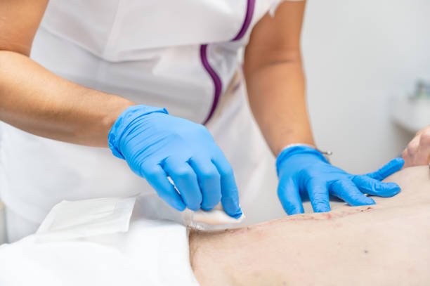 Surgical Wound Care