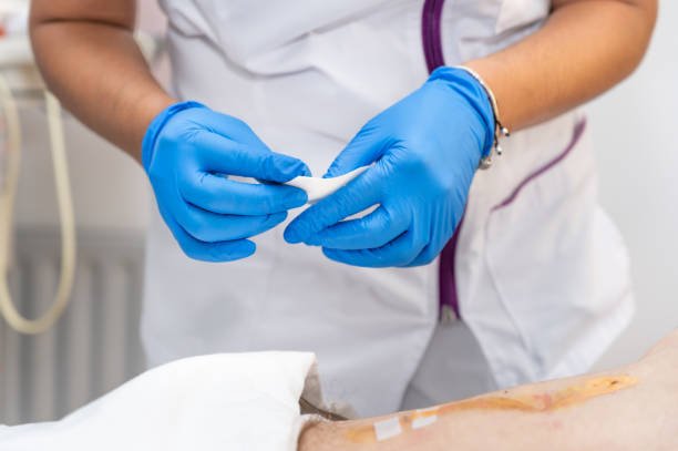 Stitch Removal (Stitch Out) at Home in Lahore