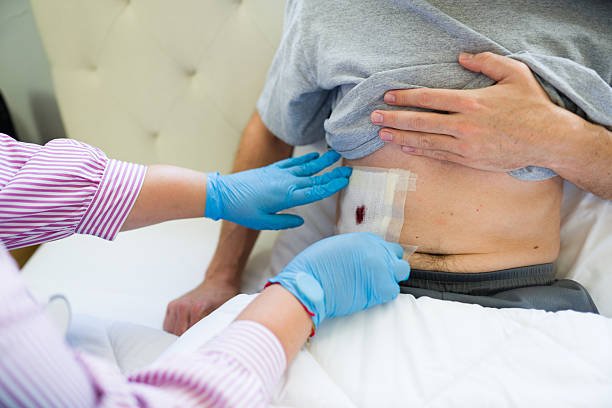 Surgical Wound Care at Home in Lahore