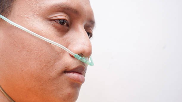 NG Tube Care at Home in Lahore