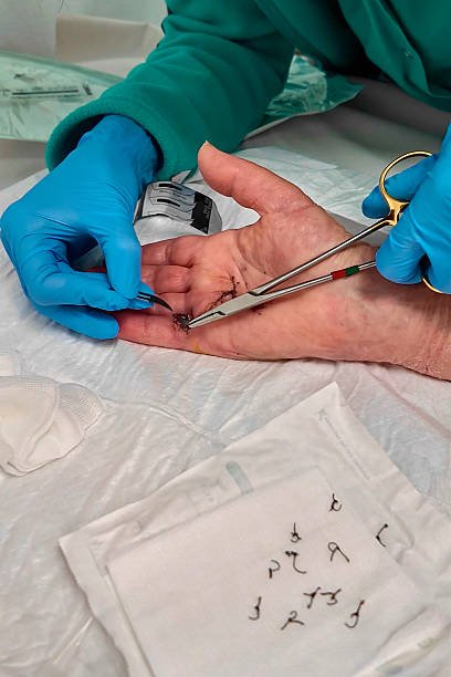 Stitch Removal (Stitch Out) at Home in Lahore